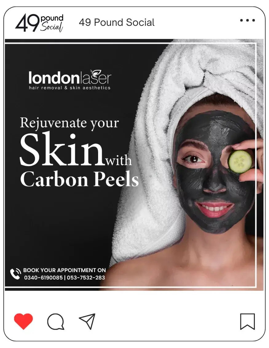 London skin care clinic promoting laser treatments on social media.
